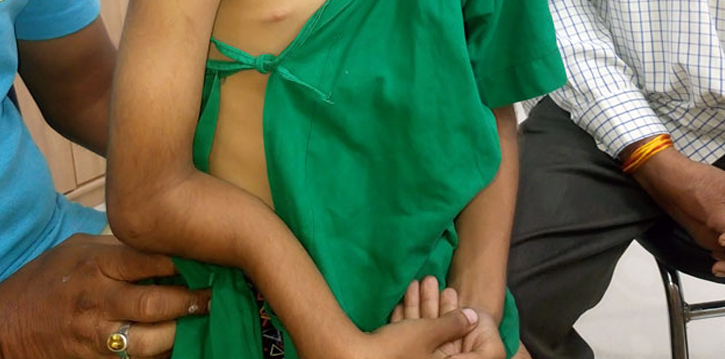 Complex Paediatric Trauma