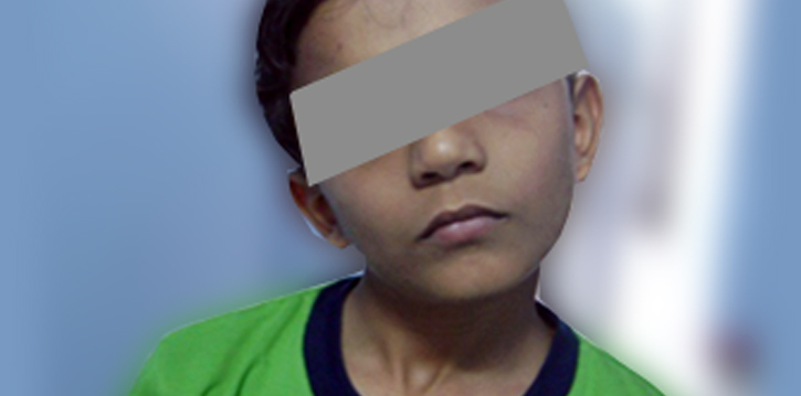 Torticollis